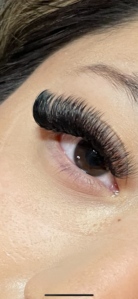 Volume Fill Set