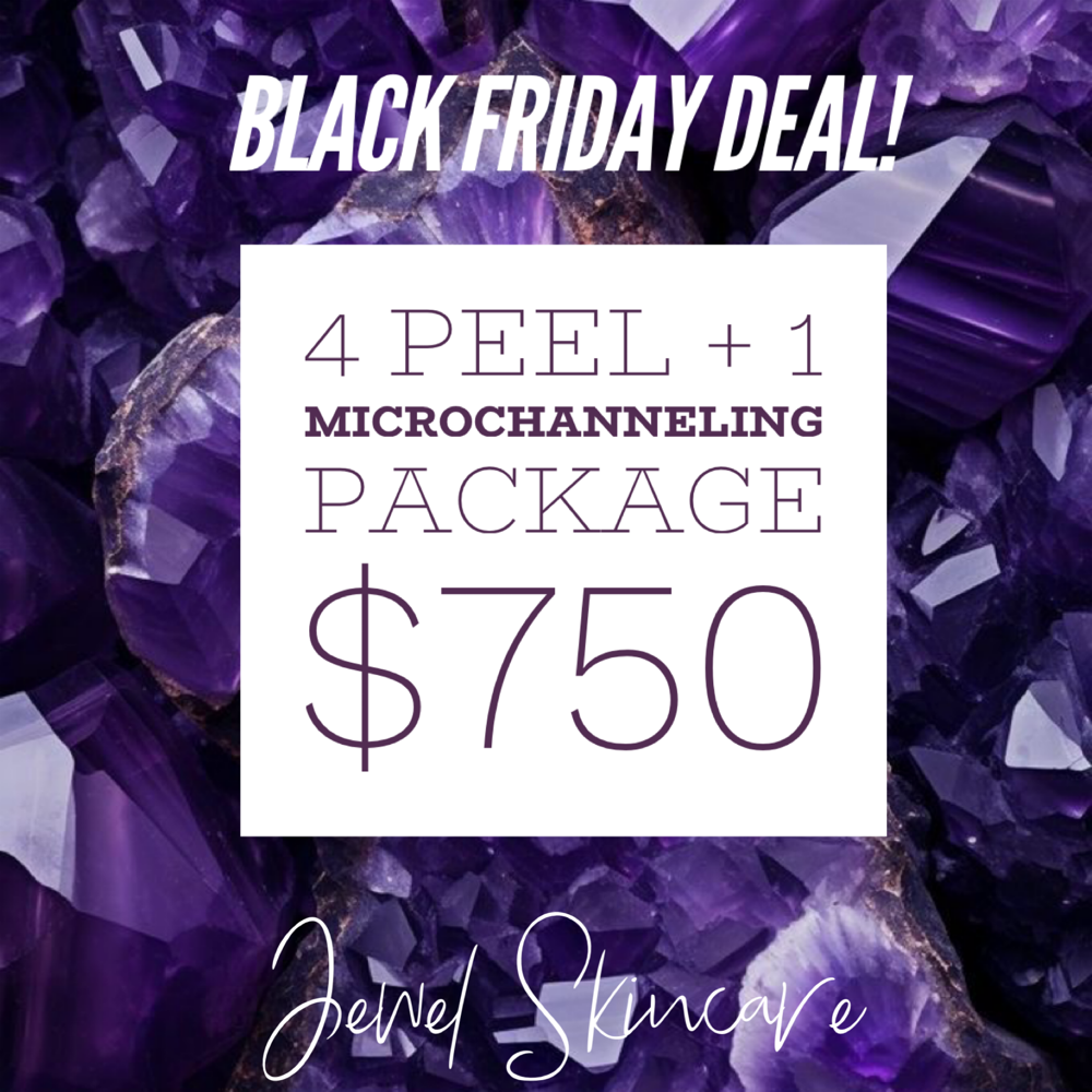 Black Friday Peel+MC Deal