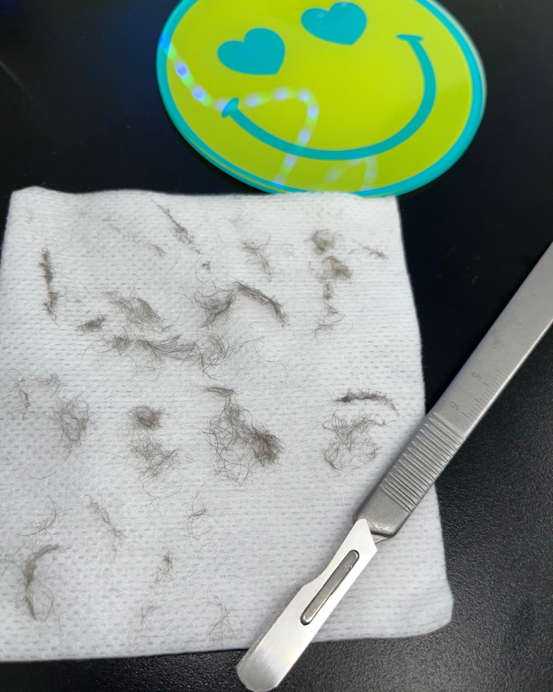 GloBabe-Dermaplane Facial