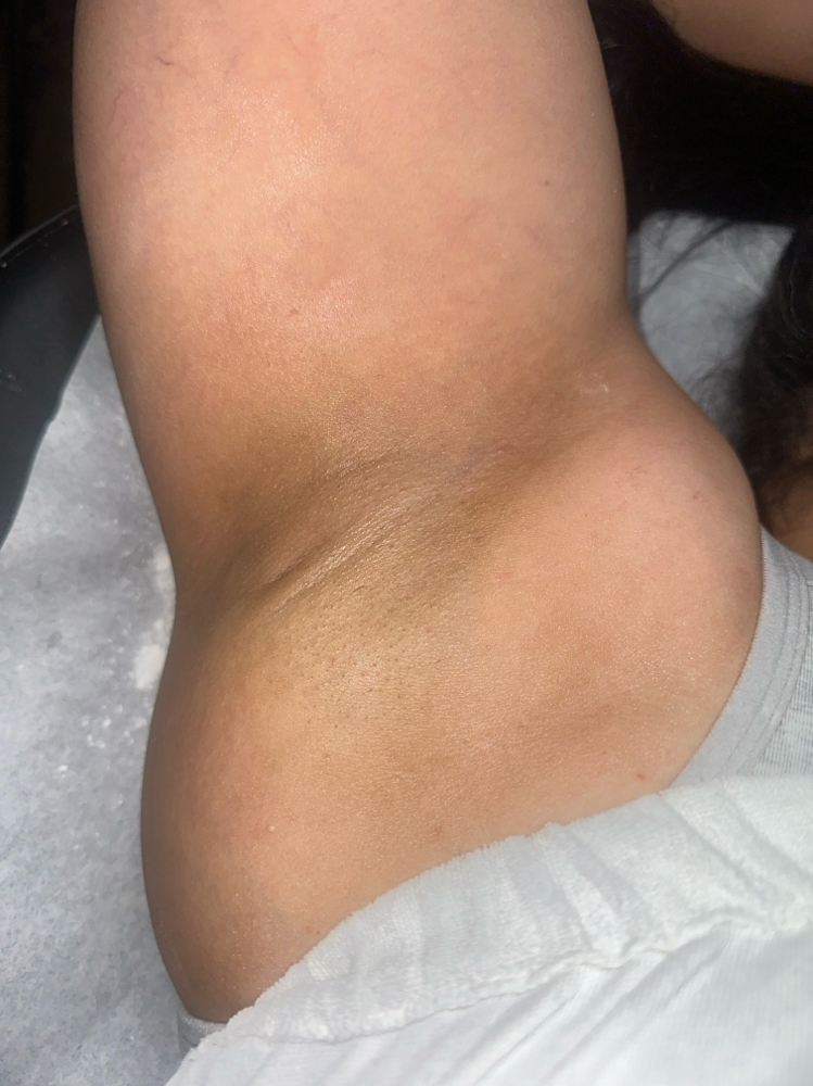 Her Underarm Wax
