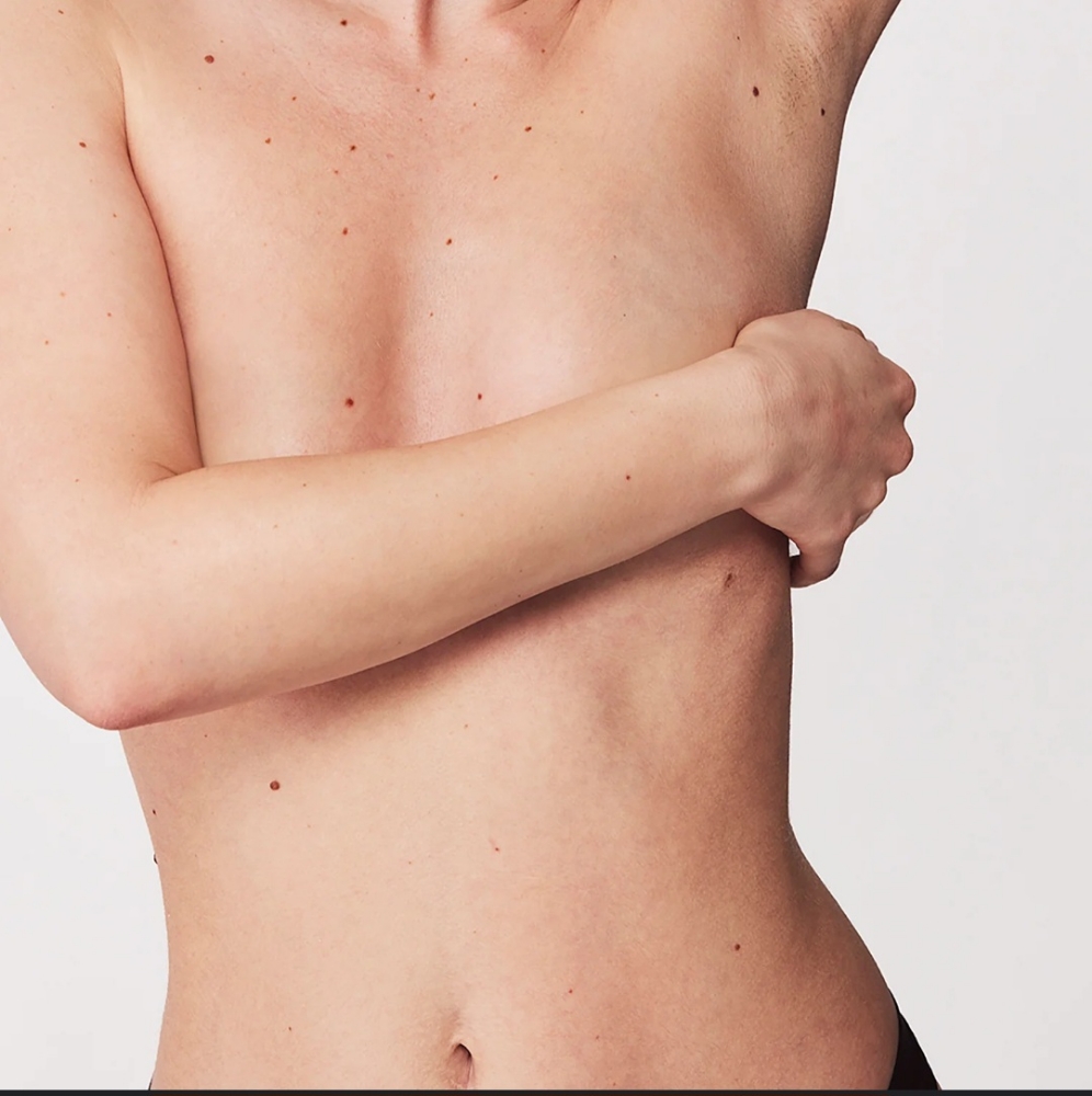 Nipples