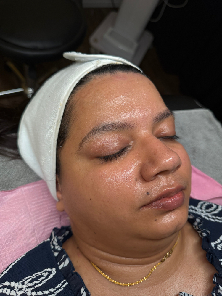 Dermaplaning+ Extraction COMBO