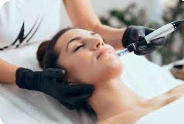 Microneedling (with PRP)
