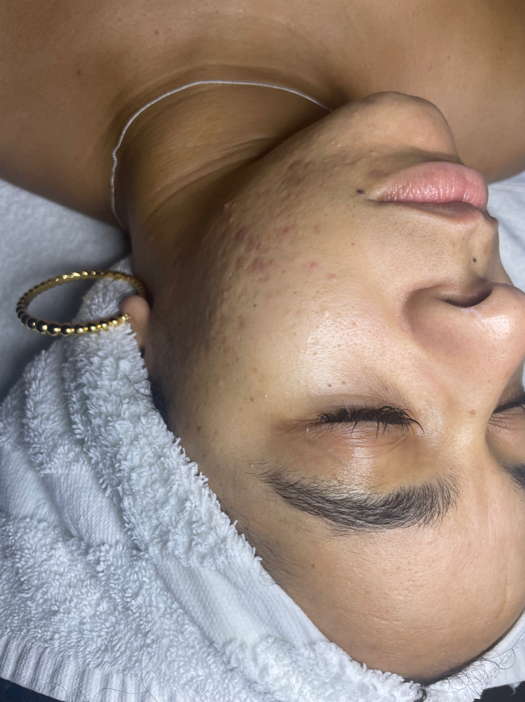 Brightening Facial