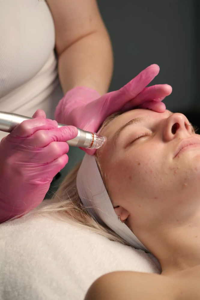 Hydrafacial with Collagen at skin.beauty.ca in San Jose, CA