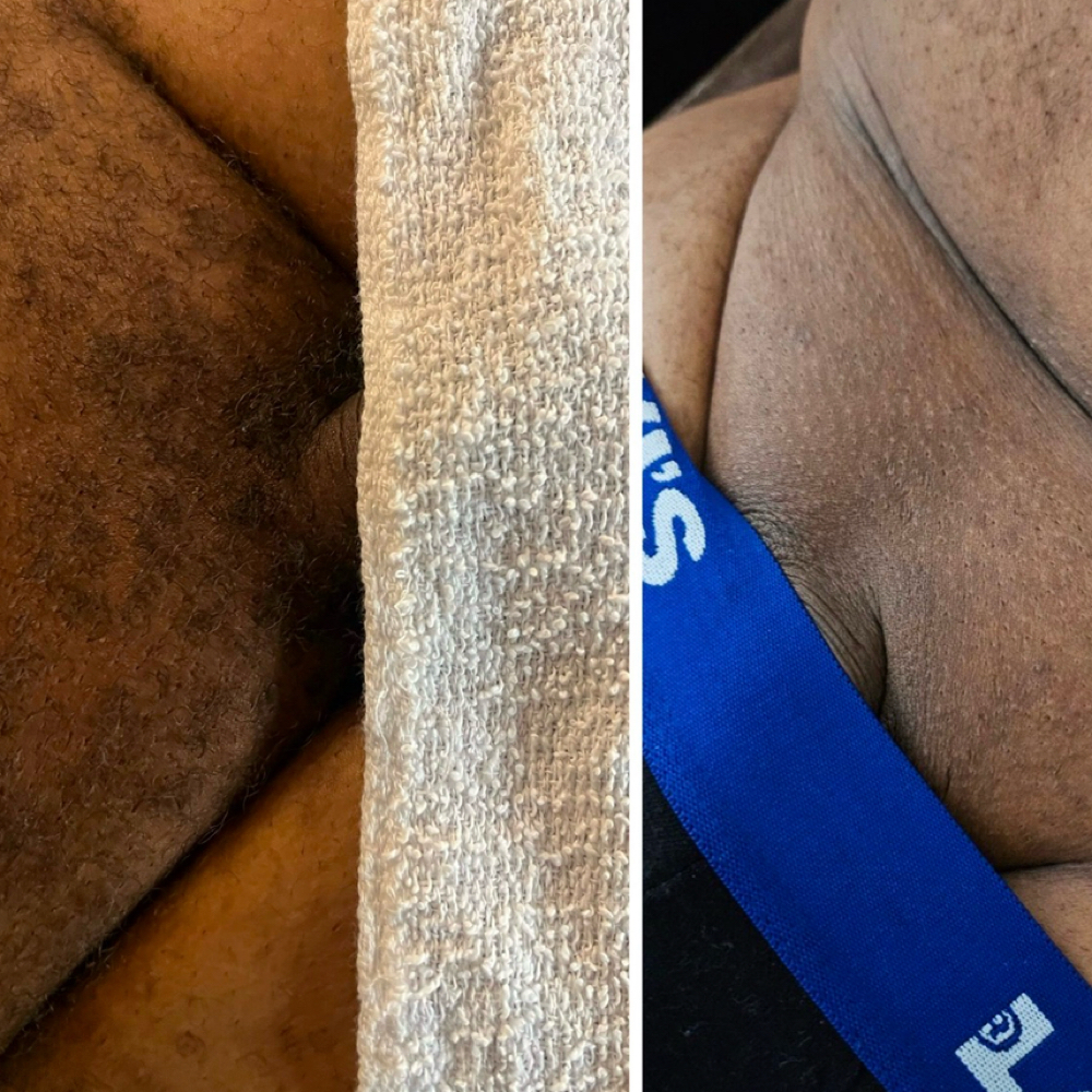 Manzilian Wax at Sacred Essence Aesthetics in Memphis, TN