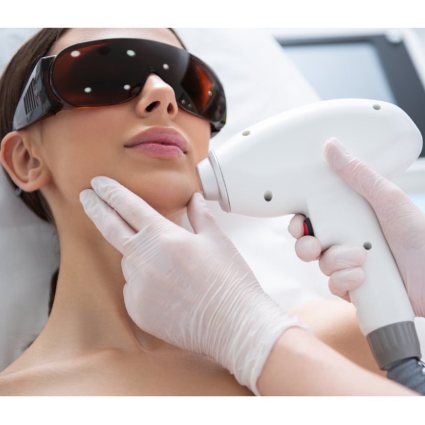 Laser hair removal- small area at Rei’A Esthetics in Yonkers, NY