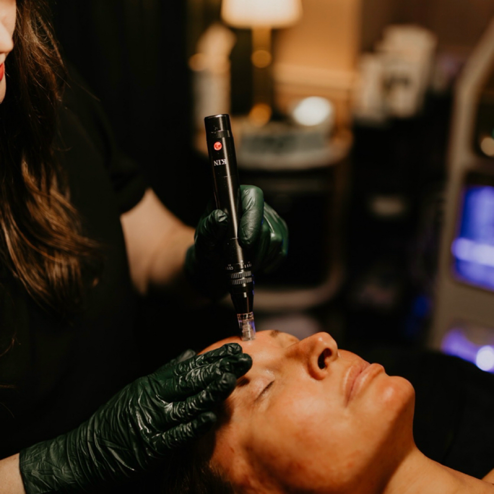 Nano-Needling Facial at The Skin Study in Huntington, WV