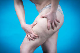 OUTSIDE & BACK THIGH FAT
