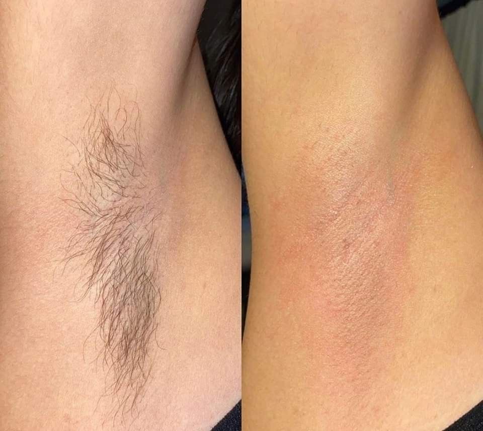 Underarm Wax
