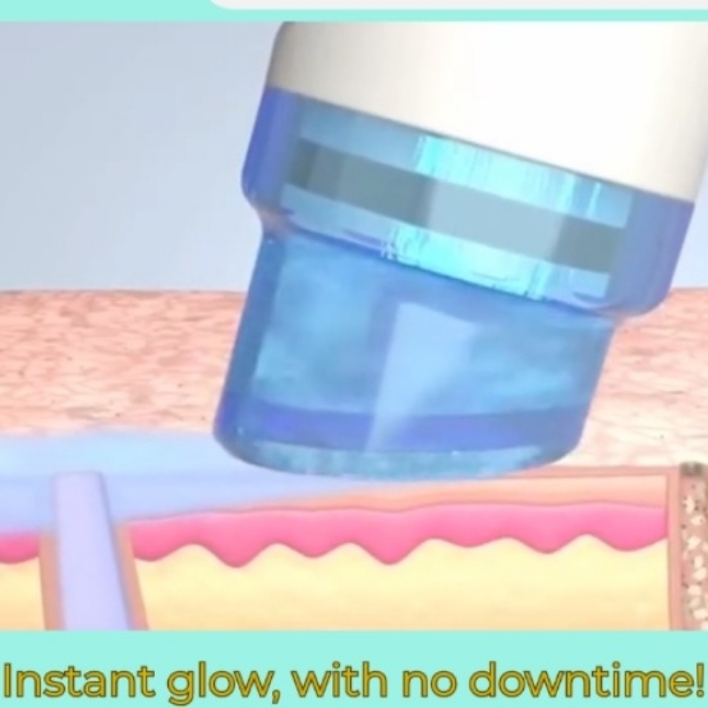 Hydrafacial Packages at Phoenix Esthetics in Southington, CT