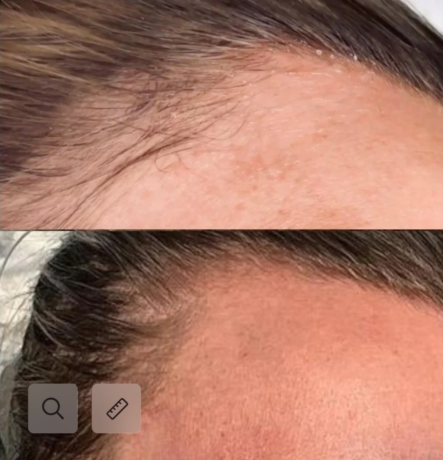 Meso Hair Solution Series