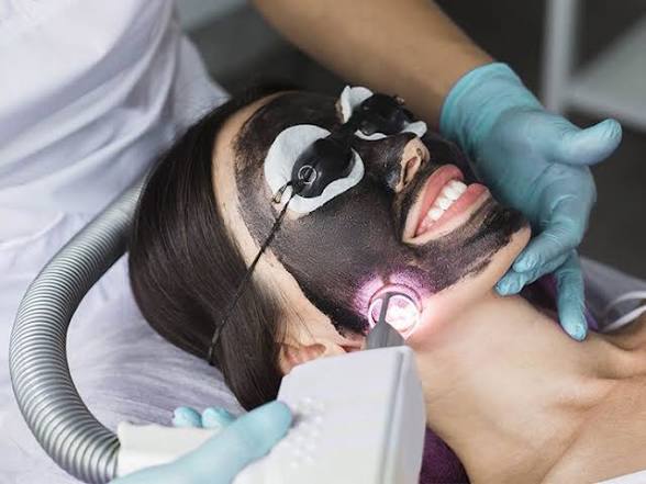 Carbon Laser Facial Red Carpet