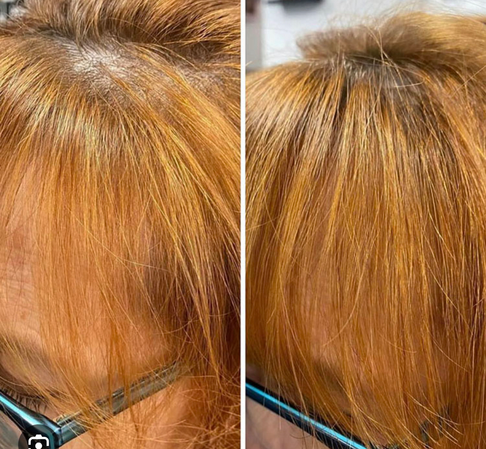 Combline Hair Enhancment Service