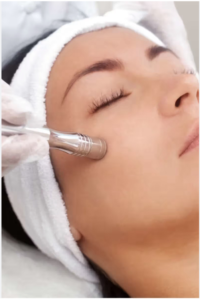 Microdermabrasion Facial