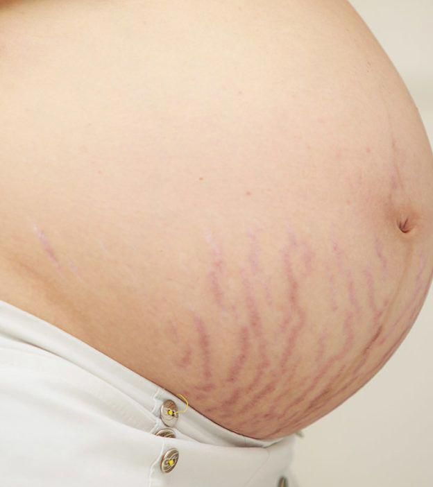 Stork Belly Facial