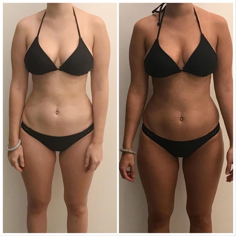 Elite Custom Spray Tan