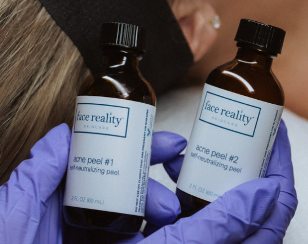 Acne B.C Facial(Established Client)