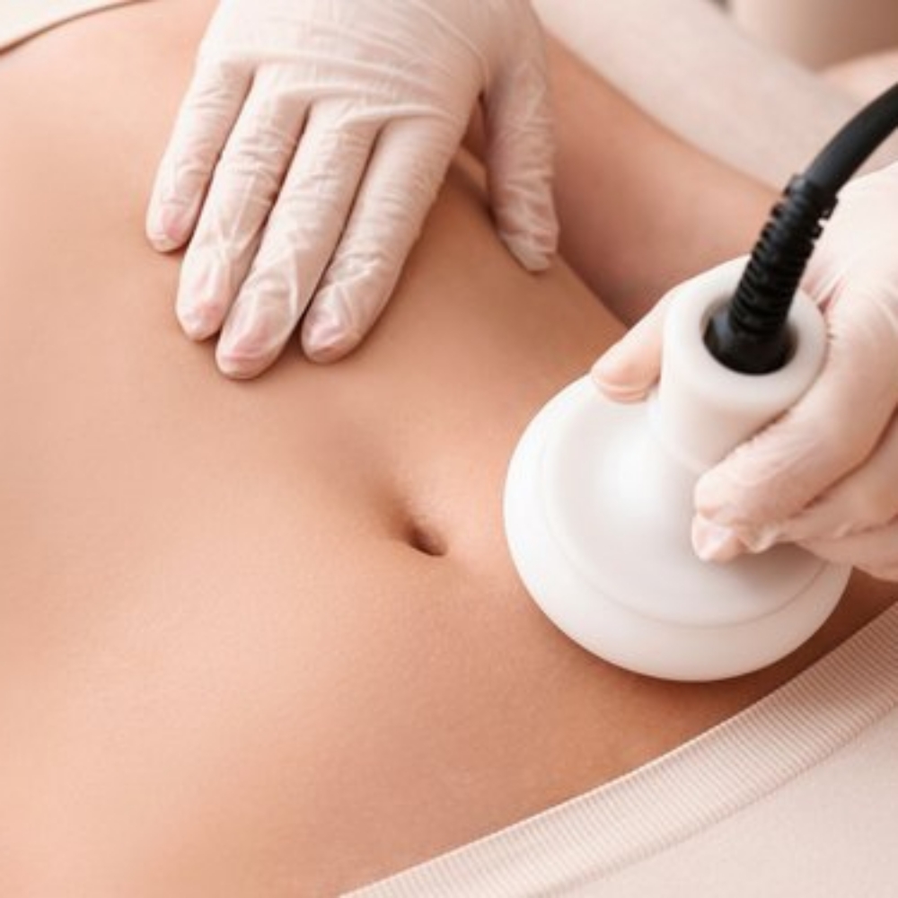 Ultrasonic cavitation at IG Body Sculpting and Wellness LLC in Denver, CO