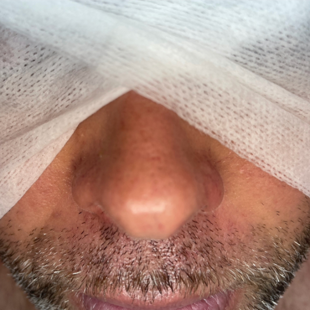 Beard Care Facial Focus at Tavaj Esthetics in Sewell, NJ