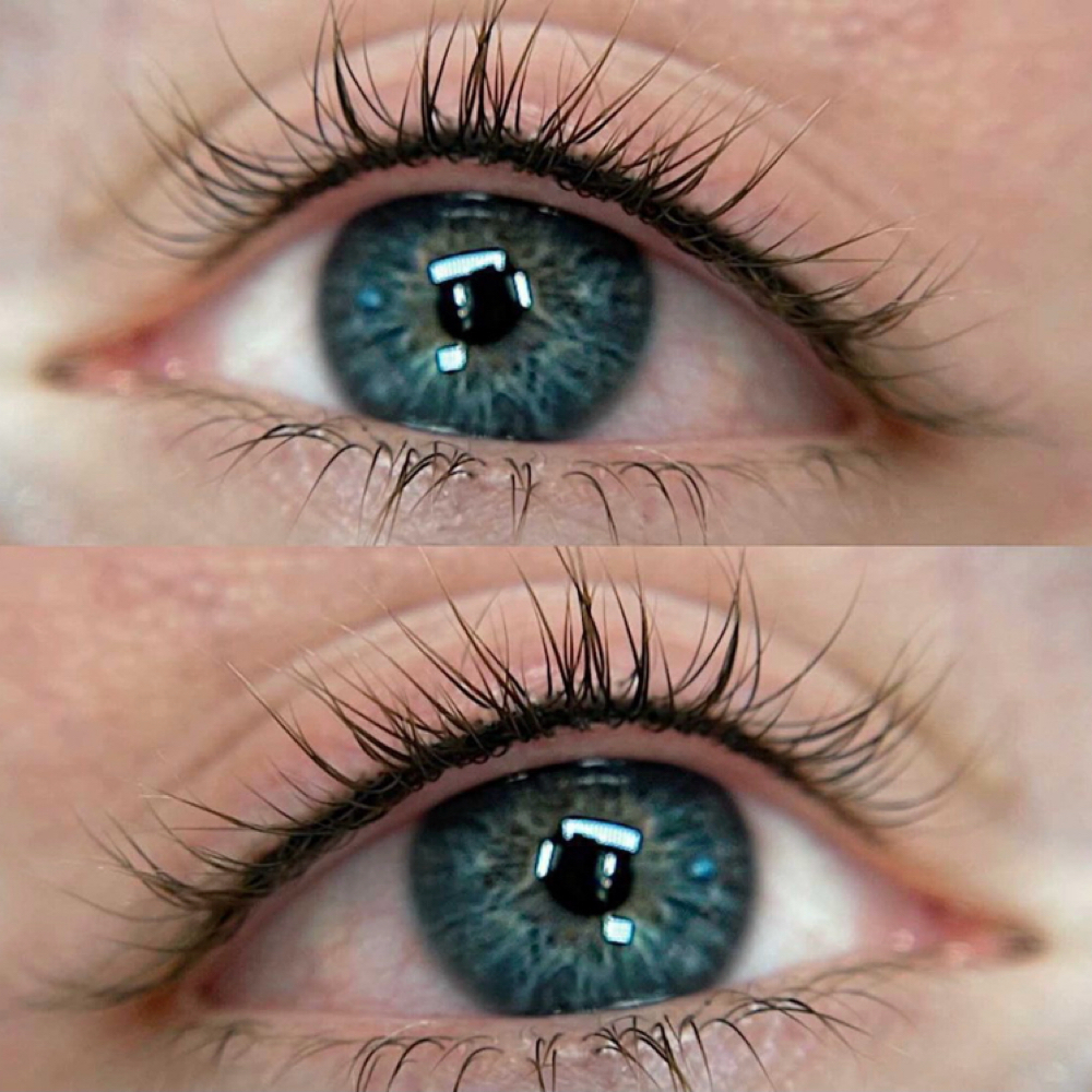 Lash Line Enhancement