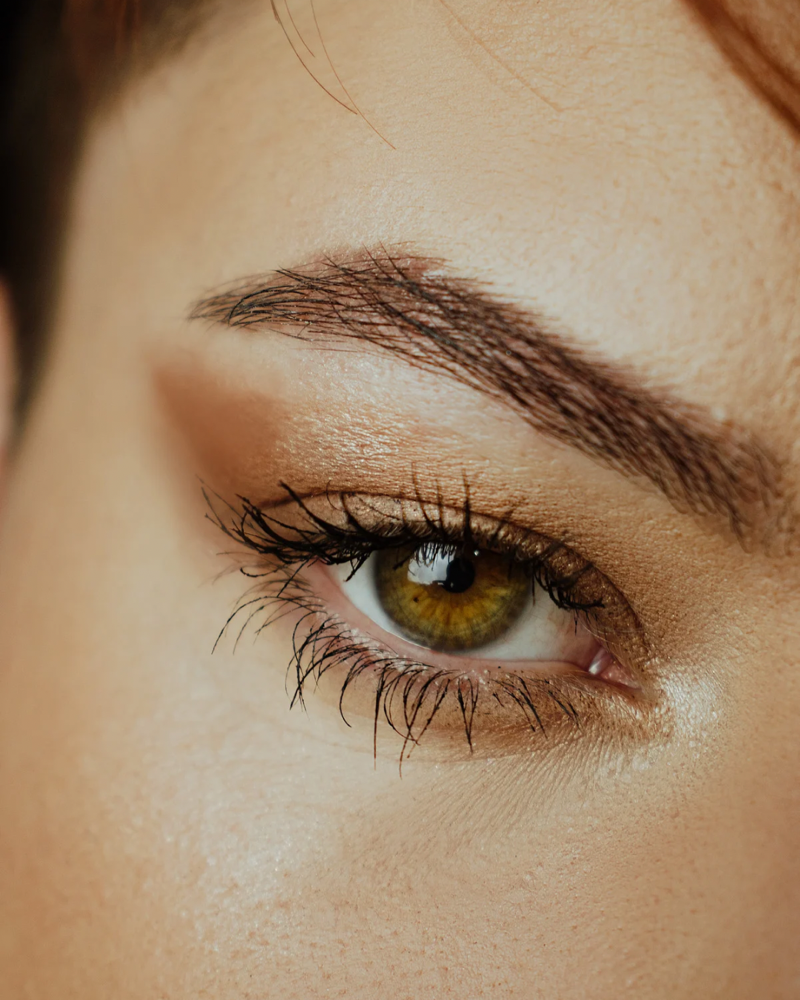 Brow Lift