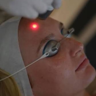 Laser genesis | collagen + glow at Corrective treatments + professional skincare in Atlanta, GA