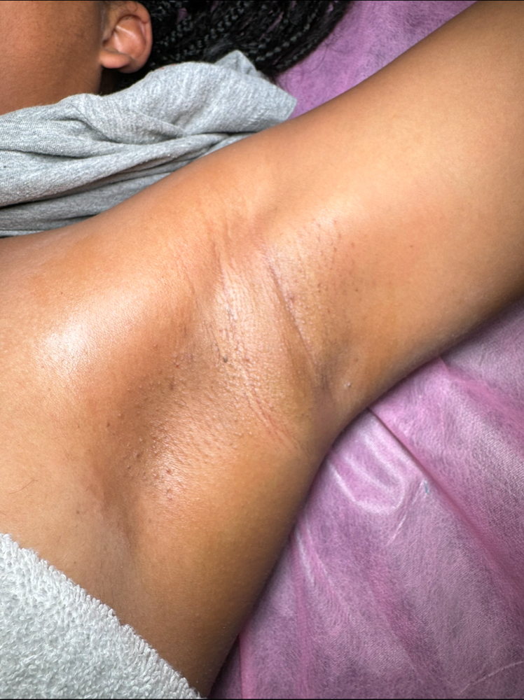 Under arm wax