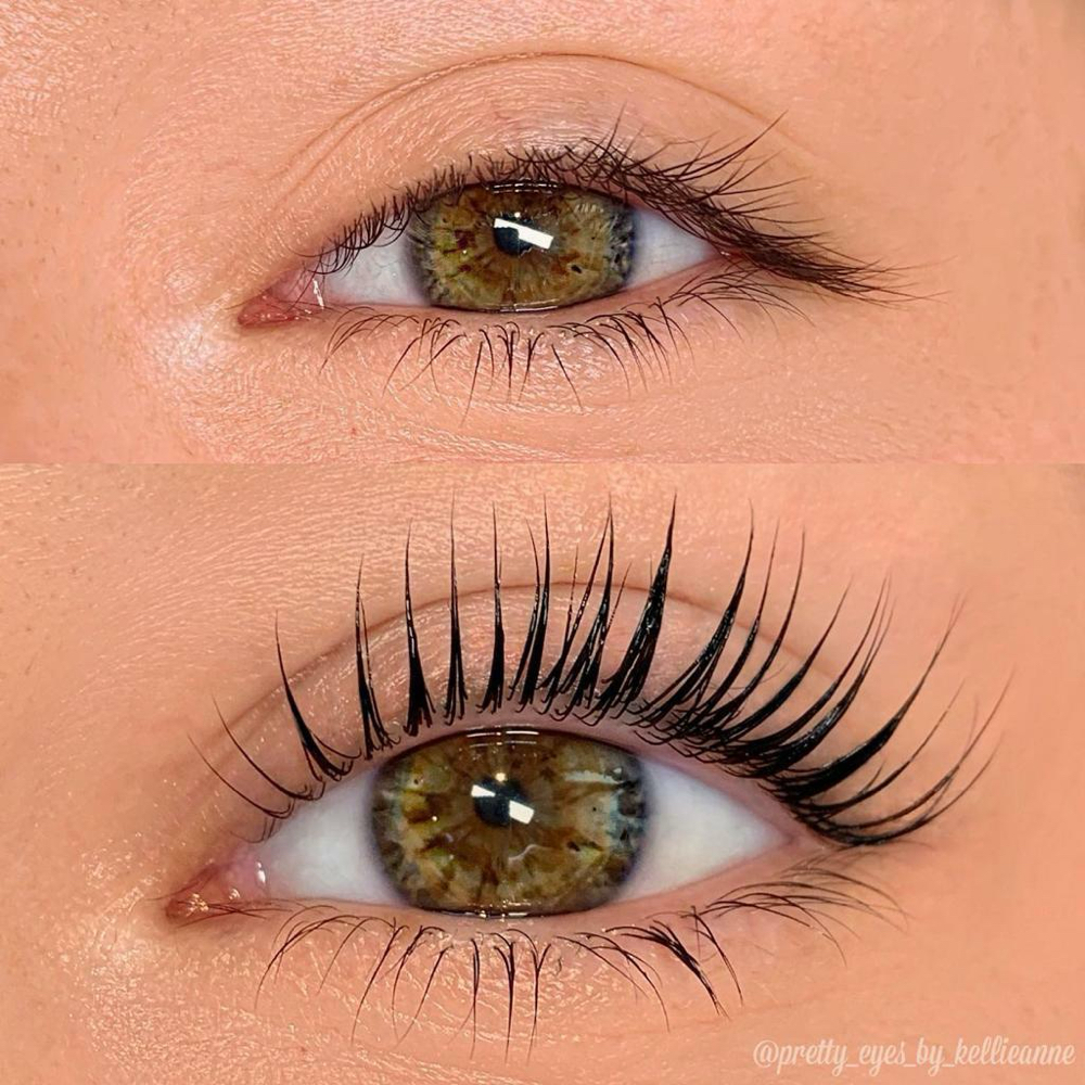 Eyelash Lift