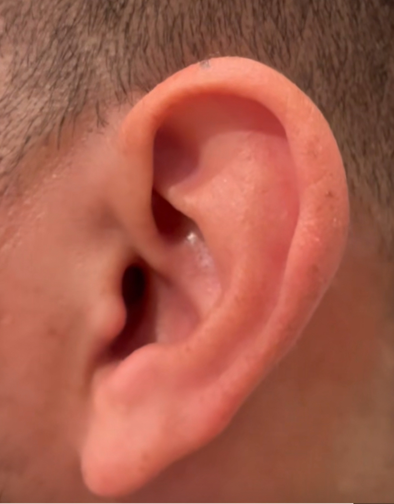 Ear  Waxing