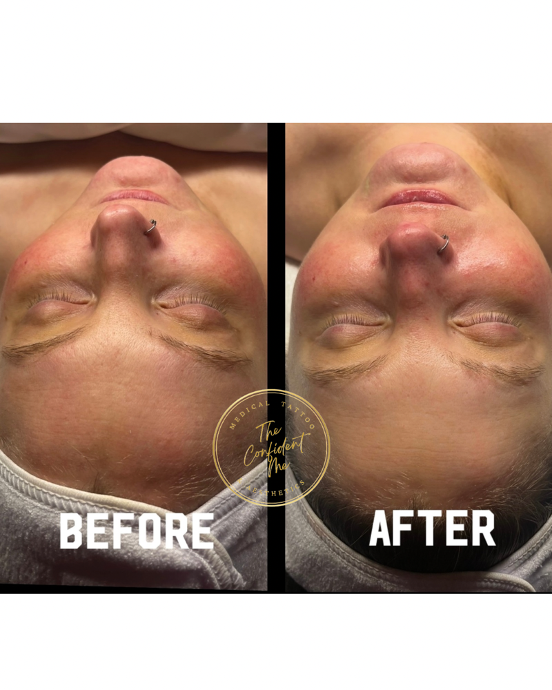 New Client Facial