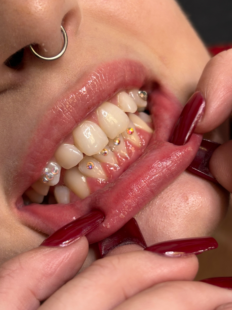 Tooth Gems