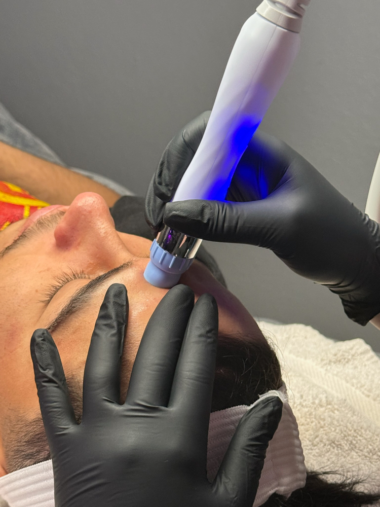Hydrofacial