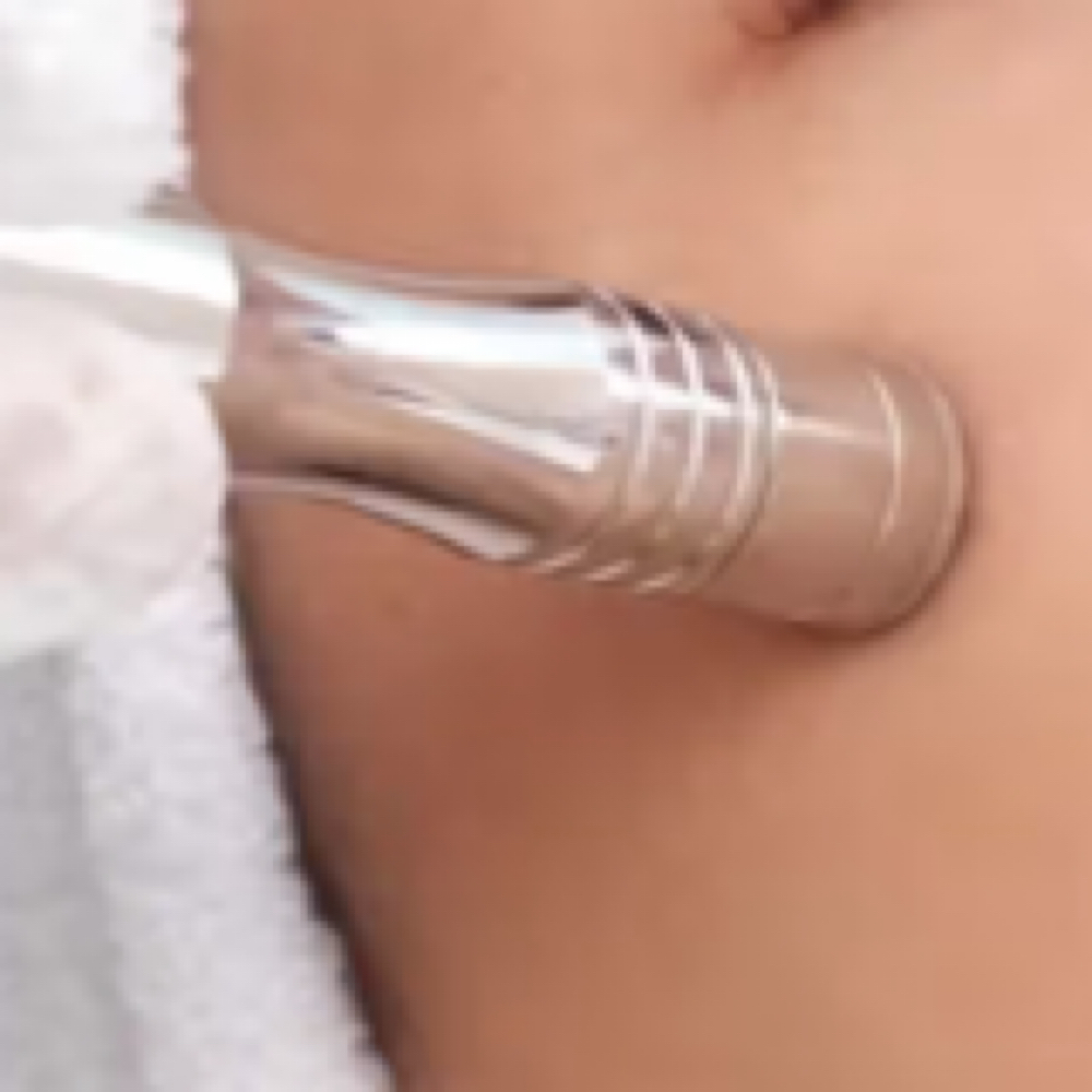 Microdermabrasion Facial at Uplift Aesthetics in Union City, TN