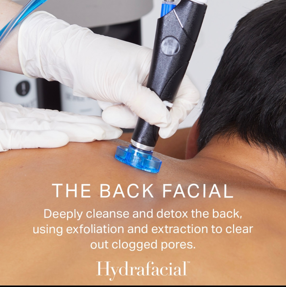 Hydrafacial Back Facial