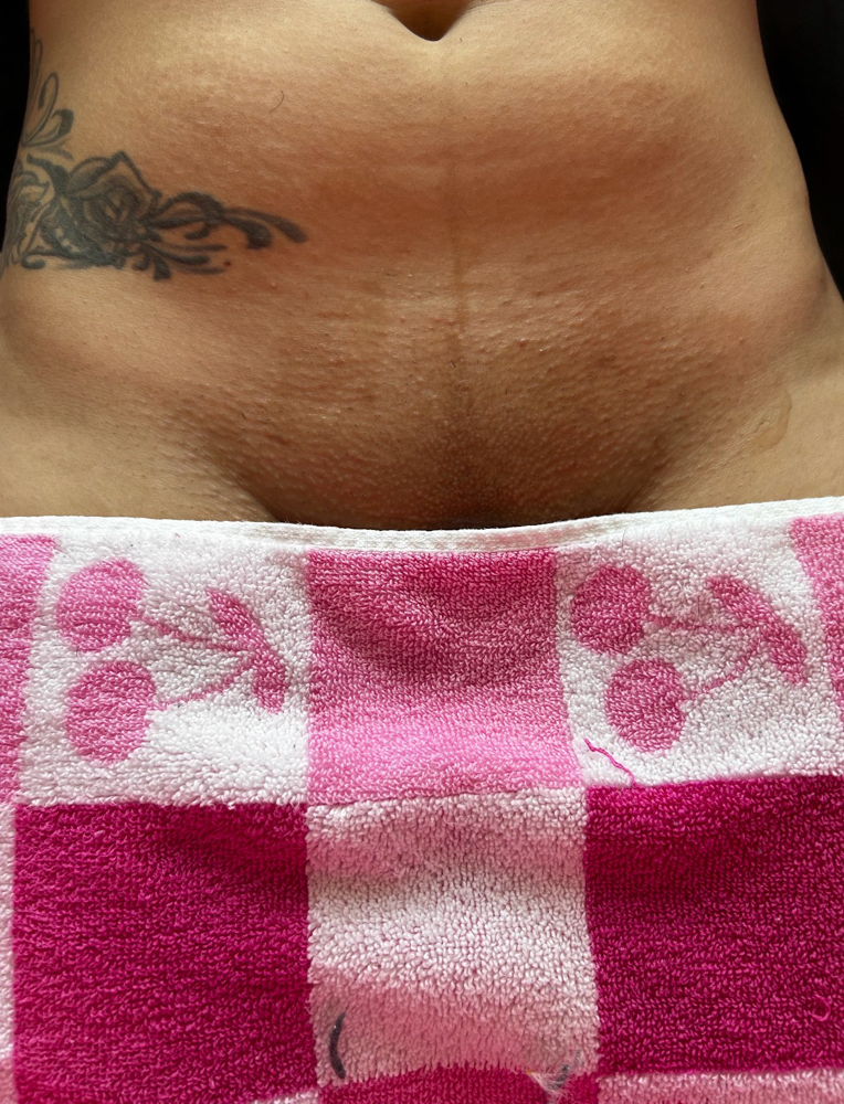 Brazilian Sugaring