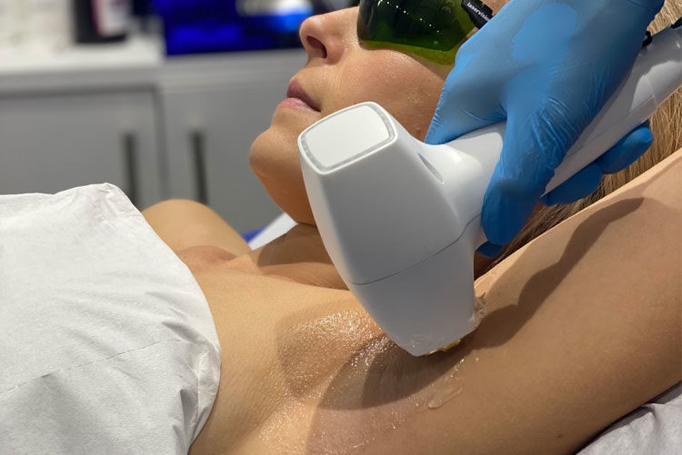 DiolazeXL Laser Hair Removal