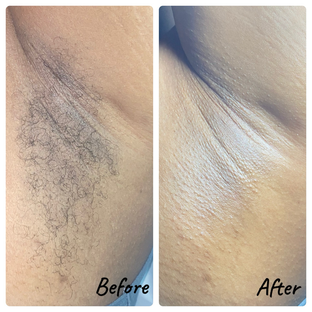 Underarm Wax at Sacred Essence Aesthetics in Memphis, TN