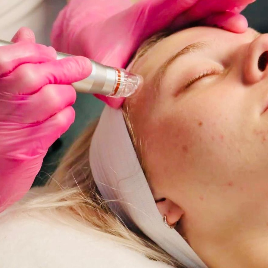 First-Time Glow Hydrafacial Express at ShanaSkincare in Gainesville, FL