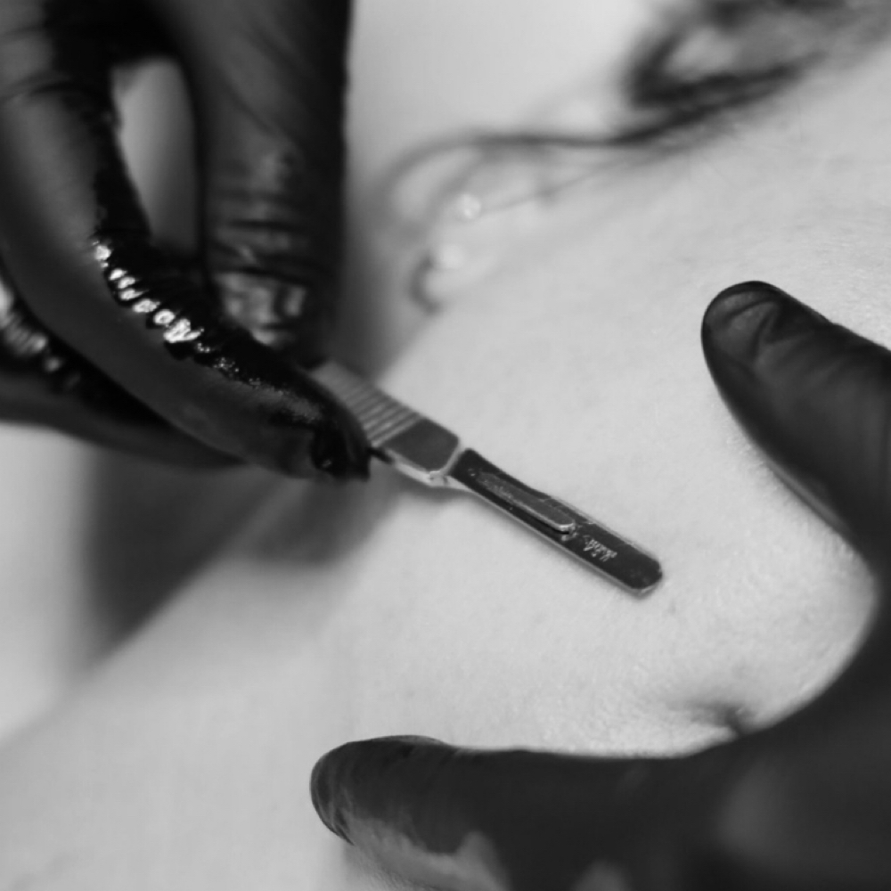 Dermaplane Treatment at Love, Lex Esthetics in Lincoln, NE