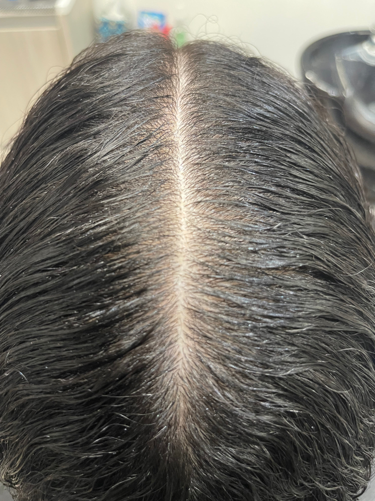 Add On Brioego Scalp Care