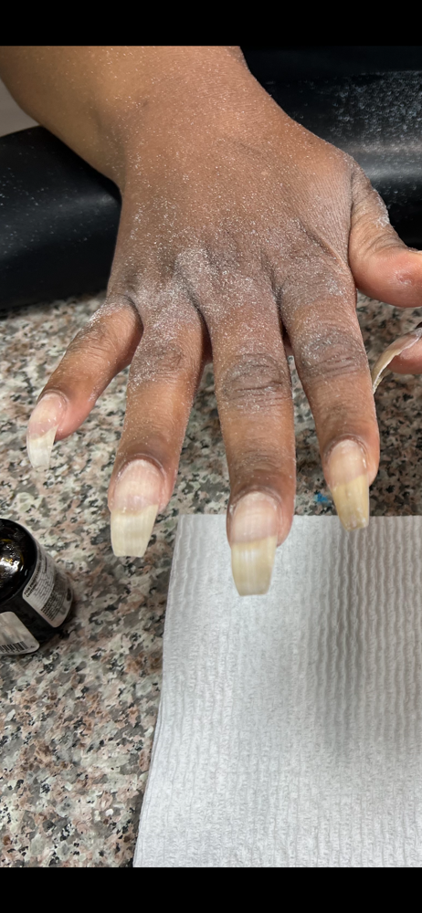 Acrylic Nail Removal/Soak-Off