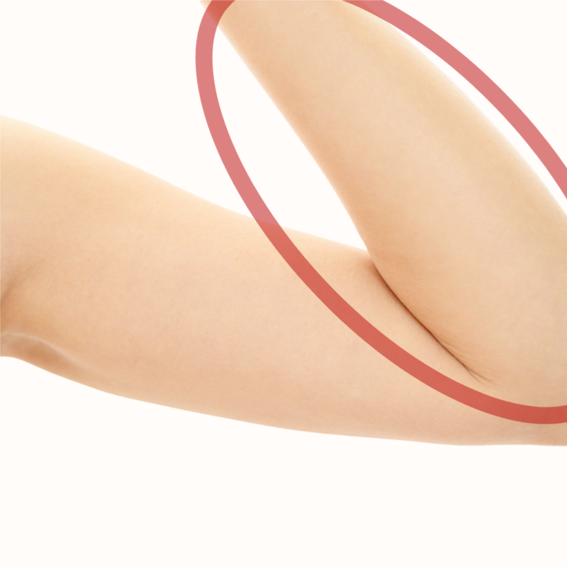 Arms Lower at Bareline Aesthetics in Brea, CA