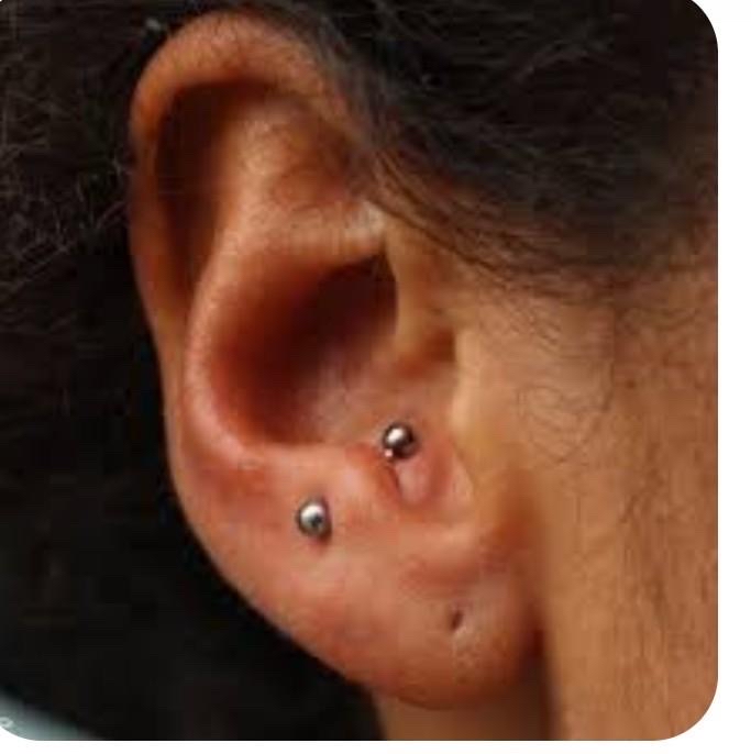Anti tragus