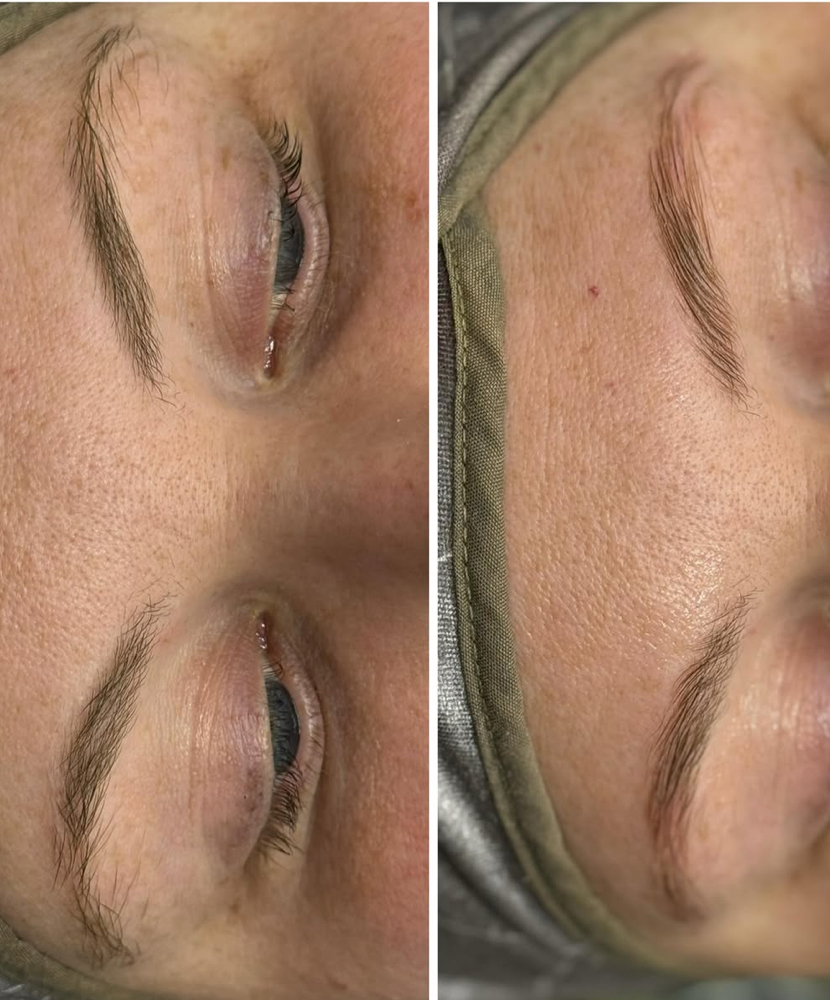 Eyebrow Lamination