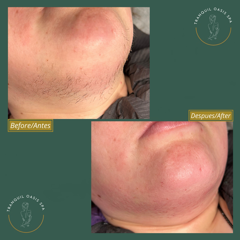 Neck Wax at Tranquil Oasis Spa in Beardstown, IL