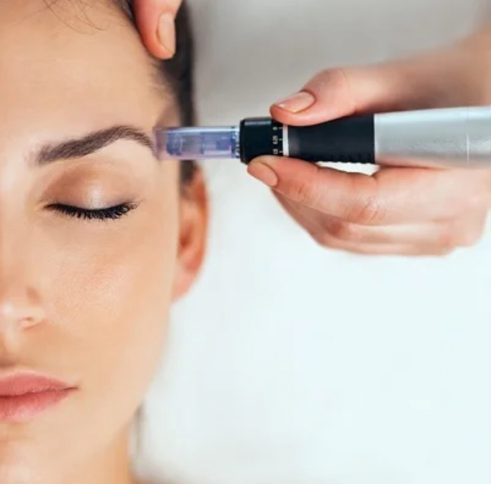 Microneedling