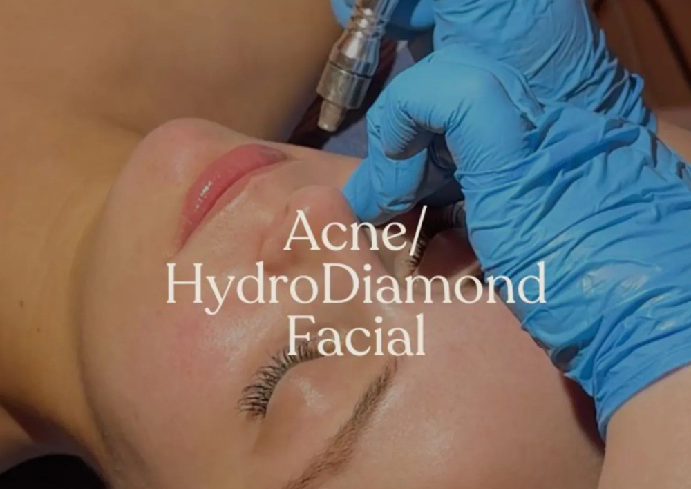NEW HydroDiamond ACNE Facial
