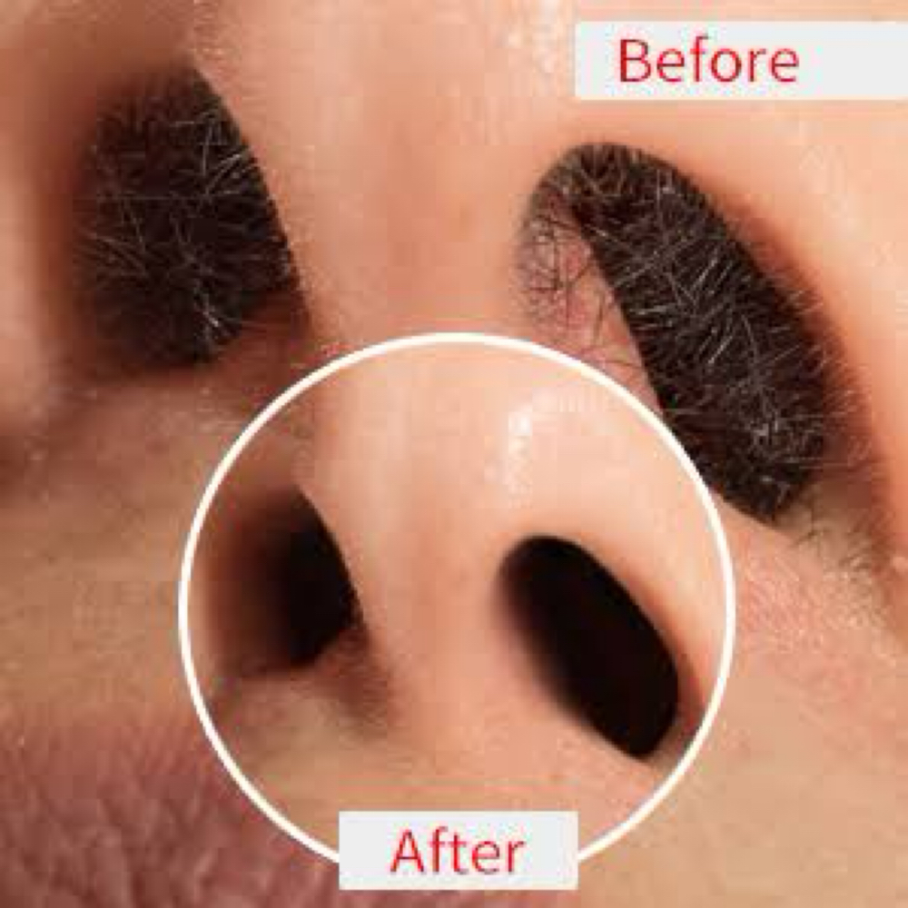 Nose Wax at The Beauty Effectt LLC in Tucson, AZ