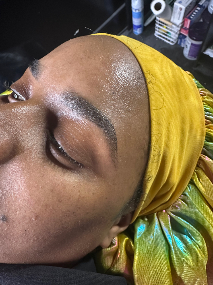 Brow Consultation